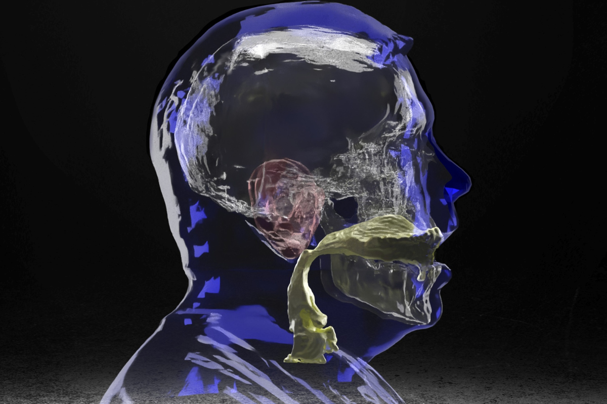 Compilation of MRI scans of a man's ear, vocal tract, skull, and external surface of his head