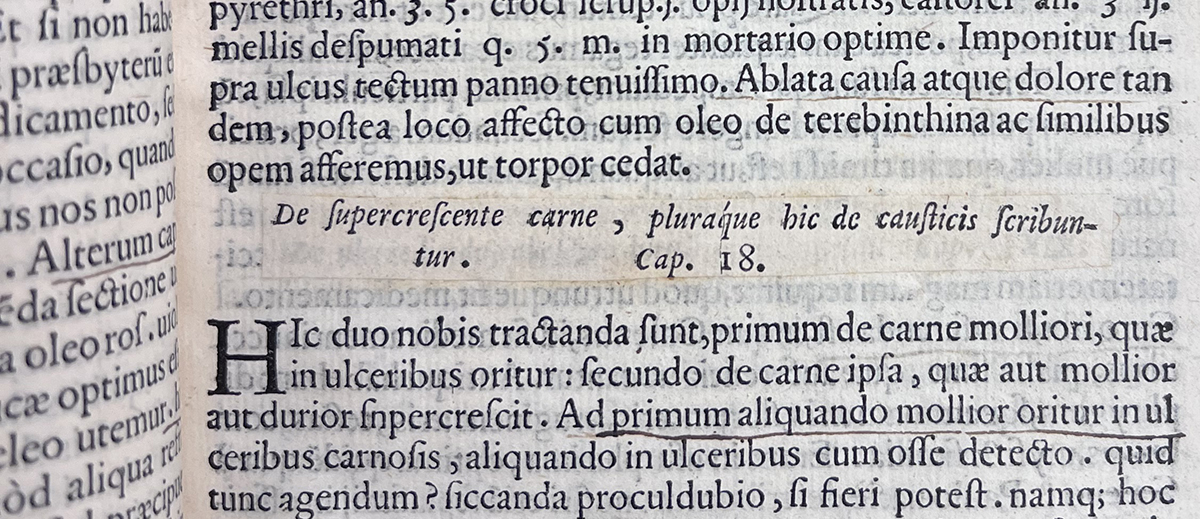 Color photo of a strip of paper with a corrected chapter title, De supercrescente carne, pluraque hic de causticis seribuntur. Cap. 18, glued over the original from Fallopius's Libelli duo, alter de ulceribus: alter de tumoribus praeter naturam, 1563.