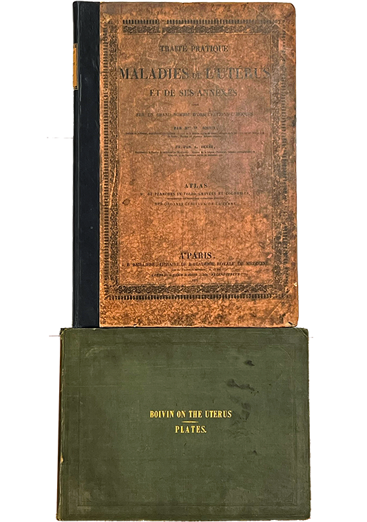 Color photo of the covers from Marie Anne Boivin's Traité pratique des maladies de l&rsquo;uterus et de ses annexes, 1833, and Practical Treatise of the Diseases of the Uterus and of its Annexes, 1834.