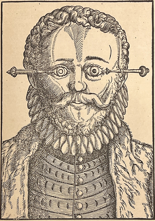 Male with curly hair and a ruffled collar with needles in his eyes, from Bartisch's Ophthalmodouleia, 1583