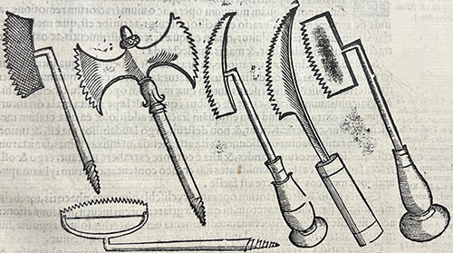 Several little saws from Croce's Chirurgiae, 1573.