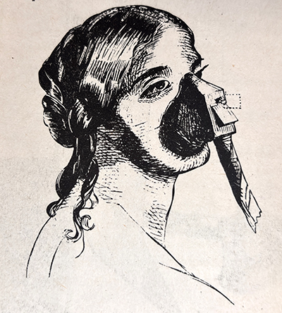 Color photo of a black and white illustration of a woman with her hair up in a traditional 19th-century style wearing a mask with a tube coming out of the bottom of it, from Snow's On the inhalation of the vapour of ether in surgical operations, 1847.