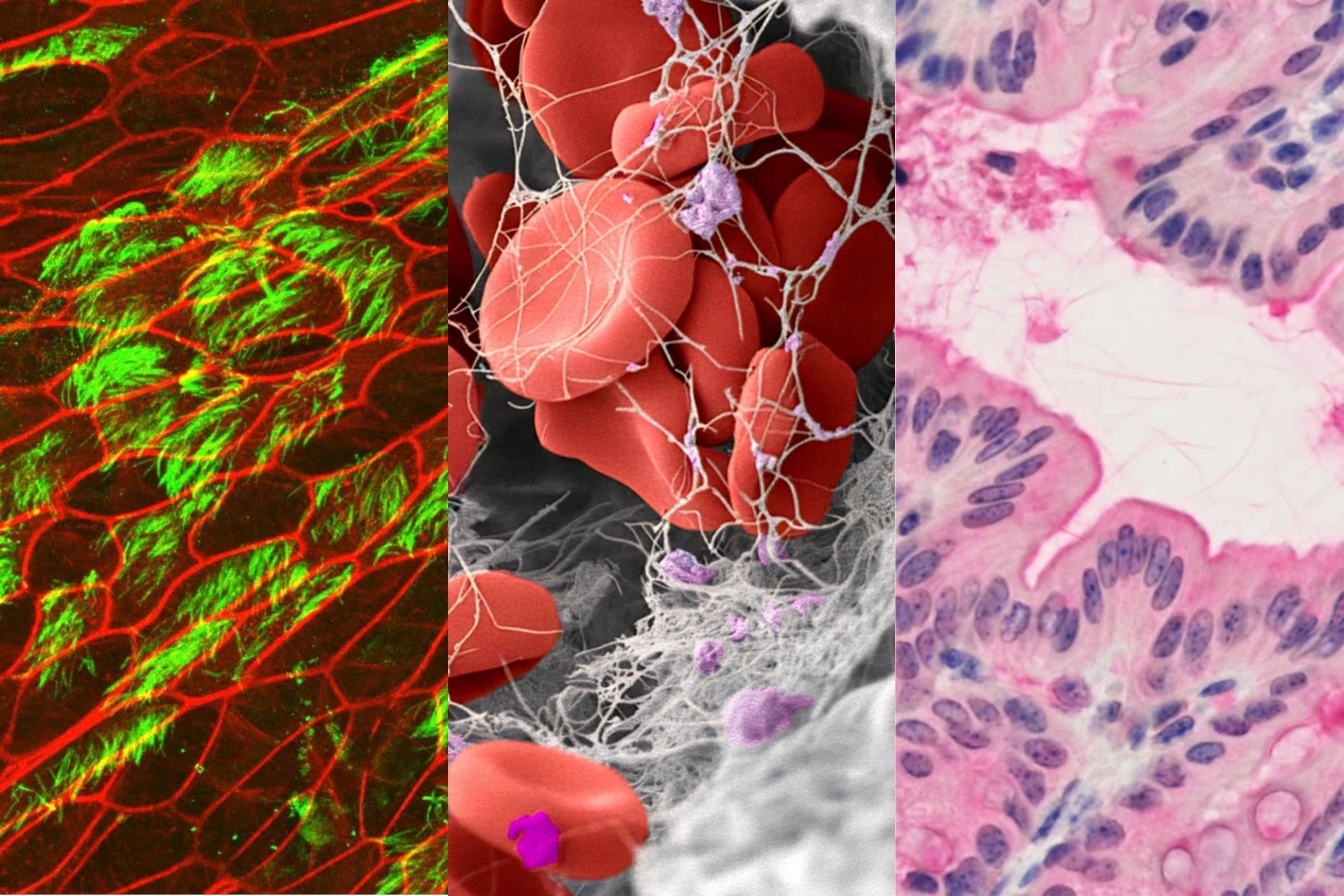 electron microscope images
