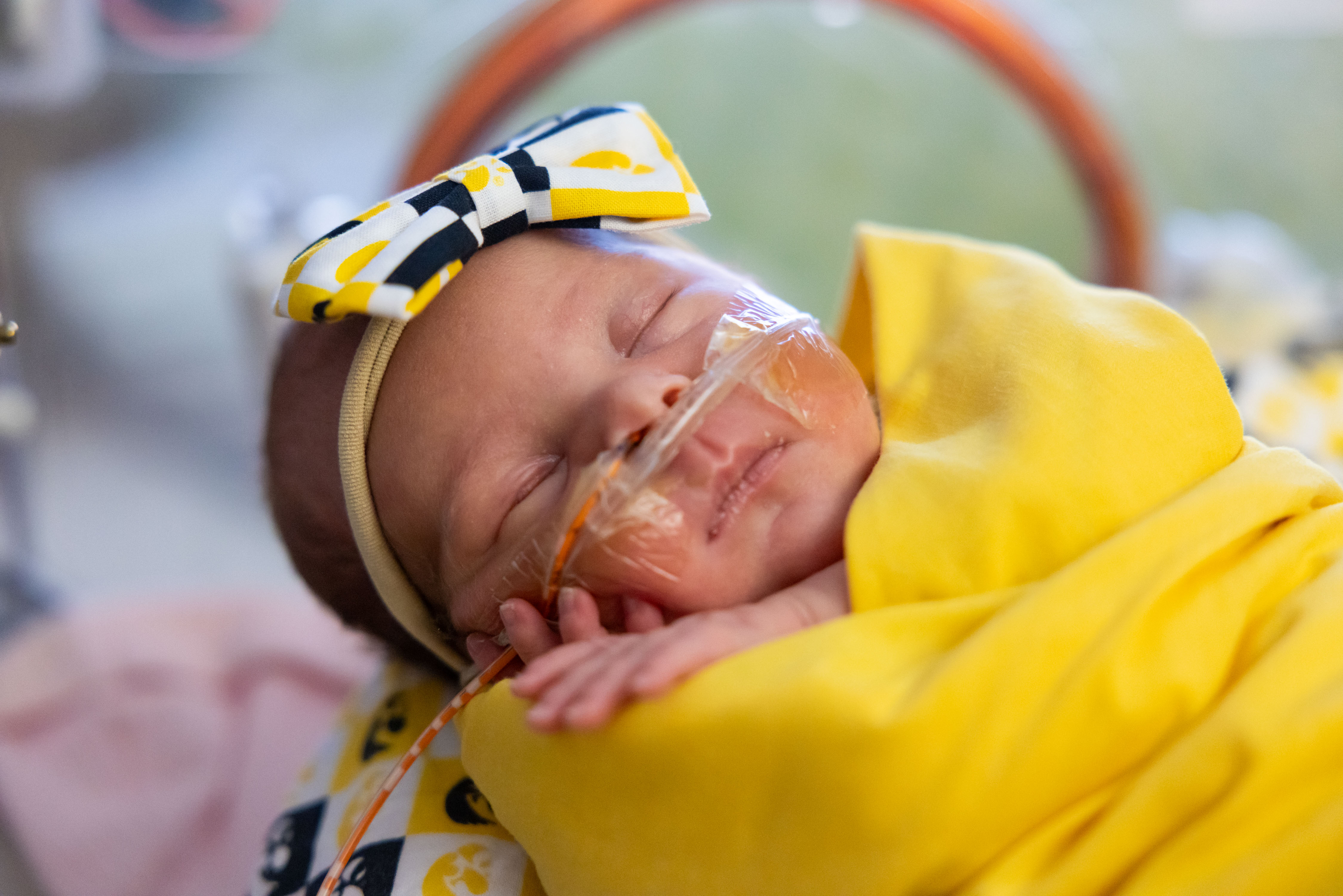 Baby in UI Health Care Stead Family Children's Hospital NICU