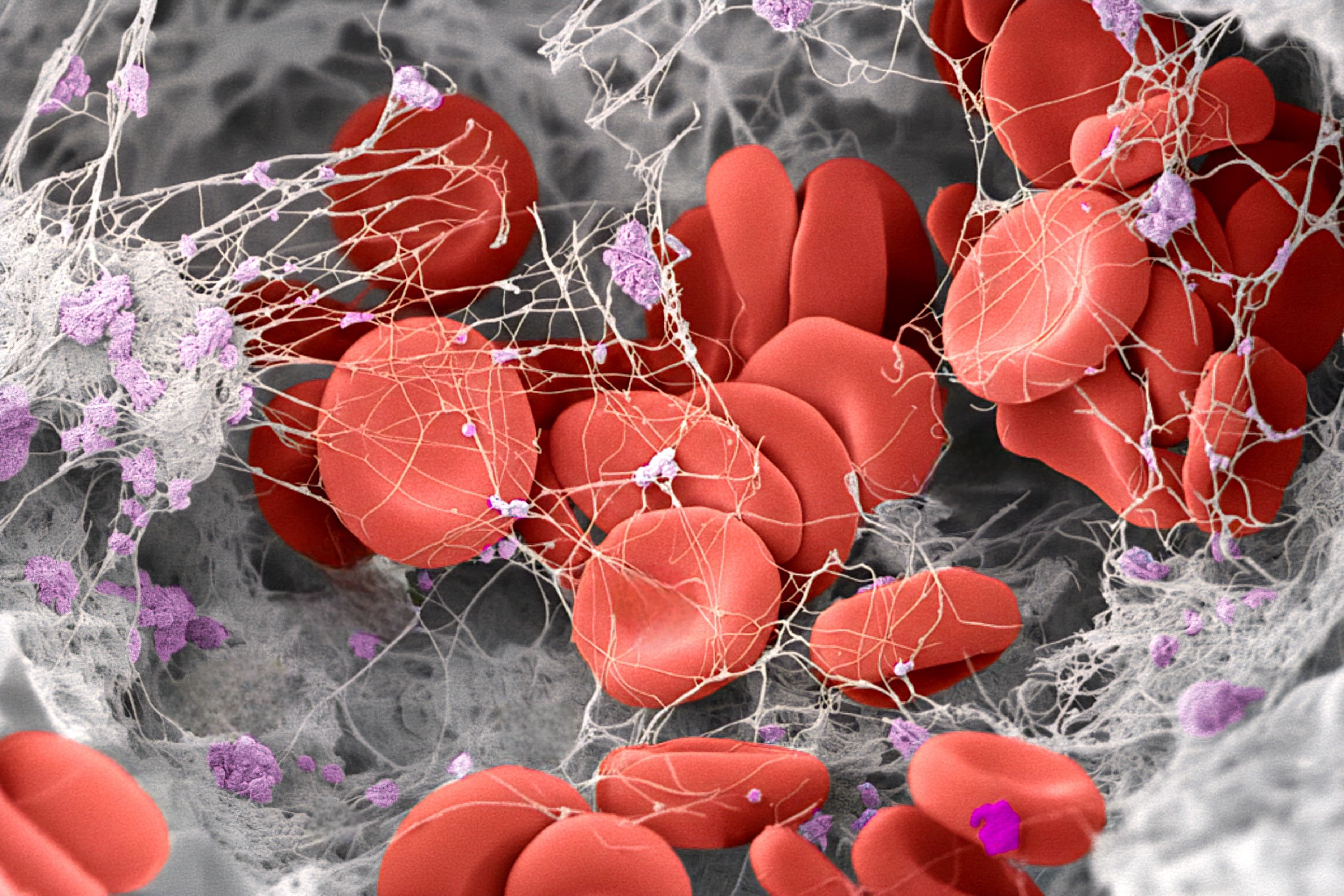 Microscope image of a blood clot in vibrant color